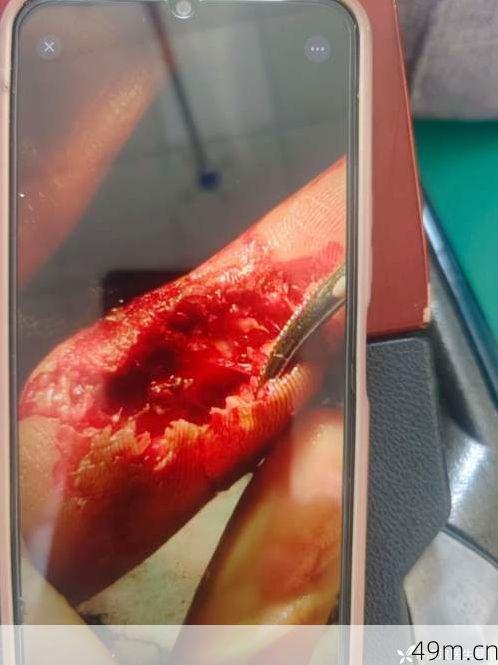 右手视频老款怎么安装